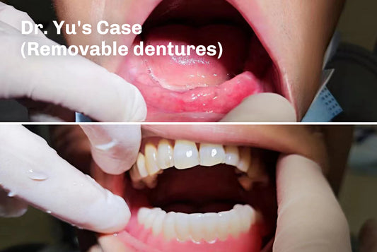 Explore a groundbreaking denture revolution!