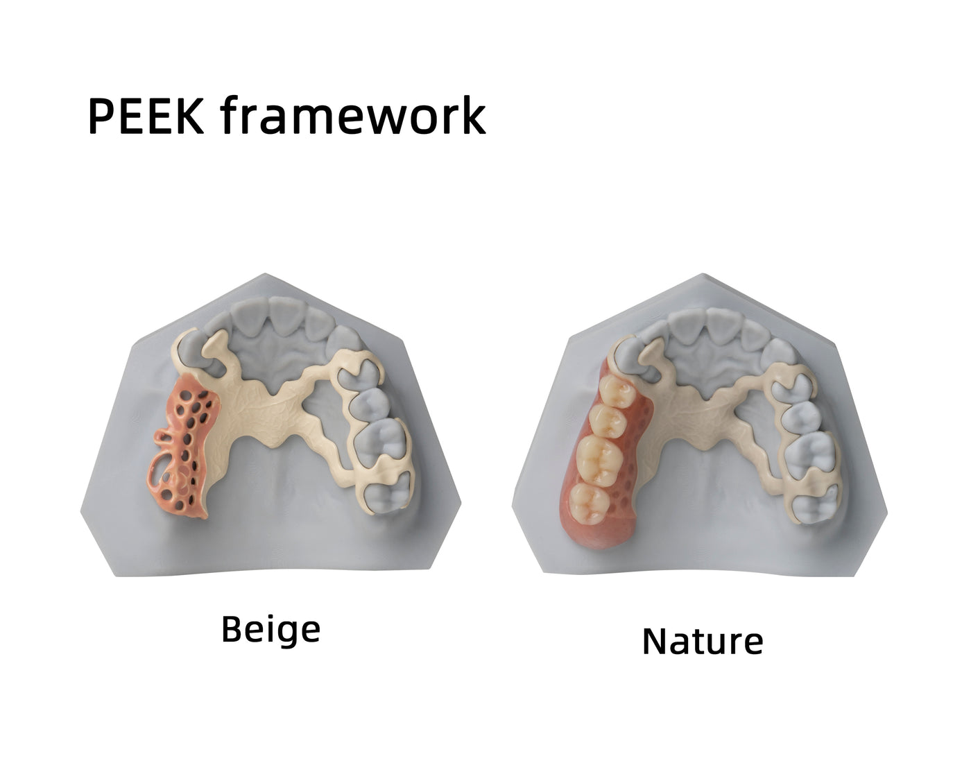 PEEK — OP(98mm)